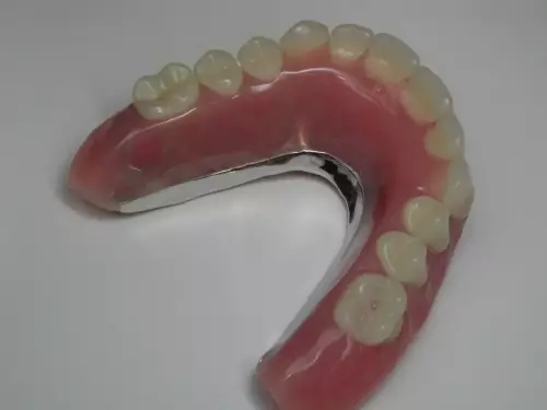 Removable Prosthesis